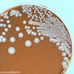 Bacteria on Petri Dish