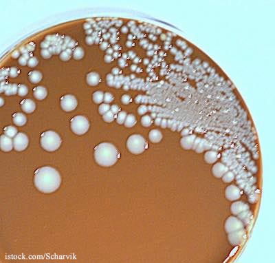 Bacteria on Petri Dish