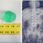 CPSC's Water Beads Safety Standard Protects Children