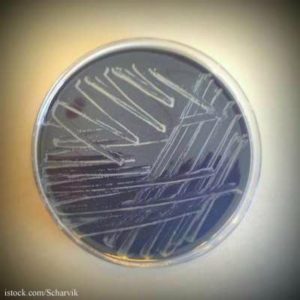 Campylobacter in a petri dish