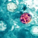 Cyclospora and Salmonella Outbreaks Increase; Remain Mysteries