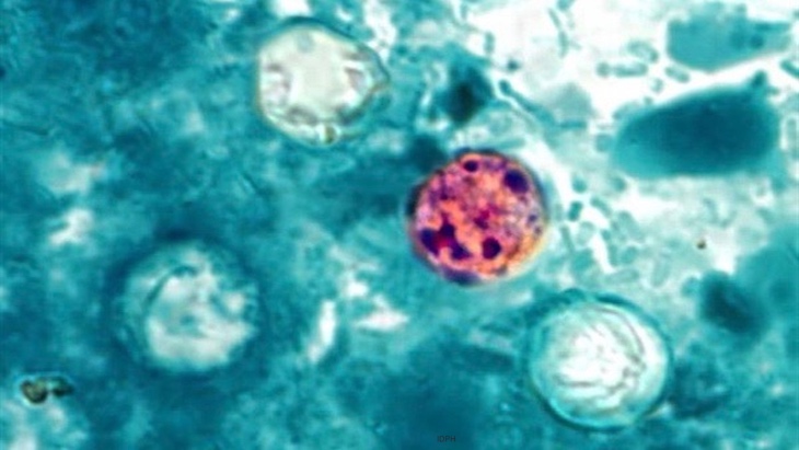 Think You Have Cyclospora? Here's What to Ask Your Doctor About Testing