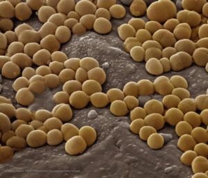 Milwaukee Police Food Poisoning Outbreak Sickens Eleven