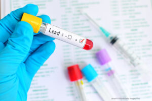 CDC Issues Alert For High Lead Levels In WanaBana Fruit Puree