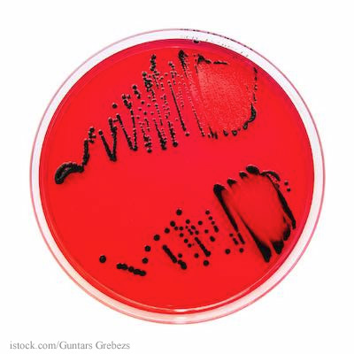 Salmonella on Agar