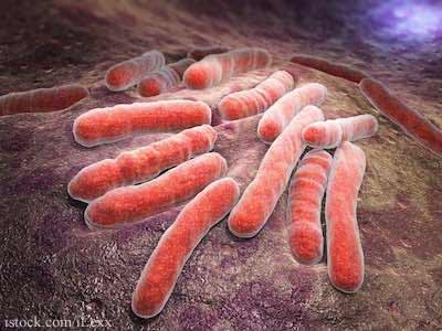 Mycobacterium Bovis Tuberculosis May Be Spread Through The Air