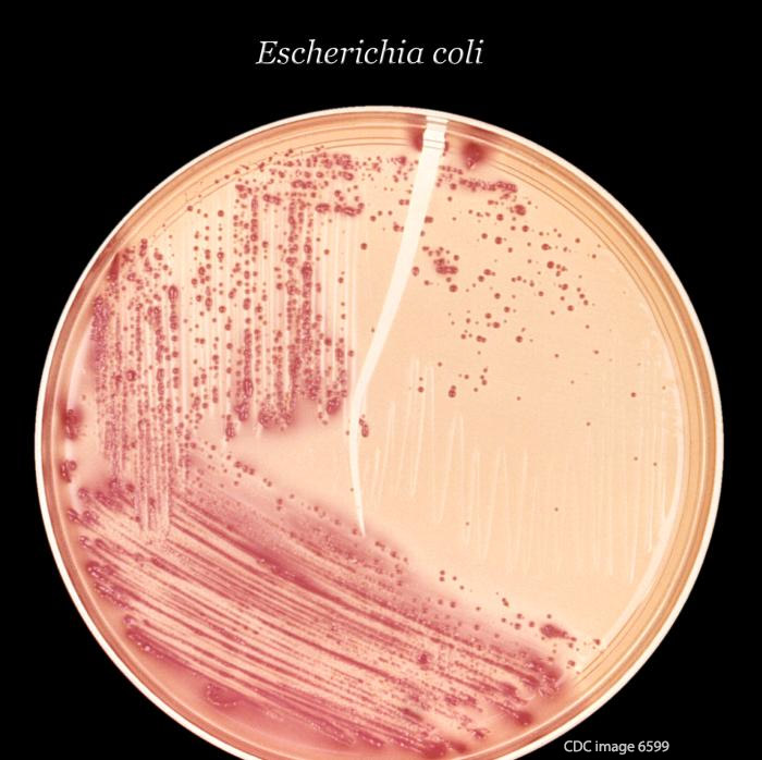 E. coli O157:H7 HUS