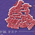 U of Arkansas E. coli Outbreak Not Linked to Public Dining Facilities