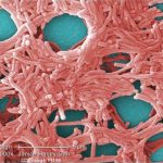 Legionella Causes Legionnaires Disease