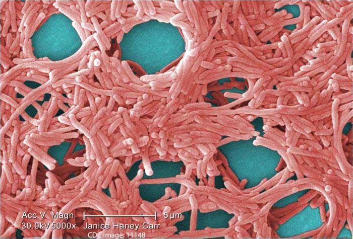 Legionella Causes Legionnaires Disease